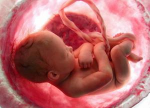 ООН просят не учреждать День безопасного аборта